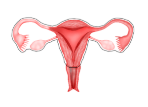 Total Laparascopic Hysterectomy